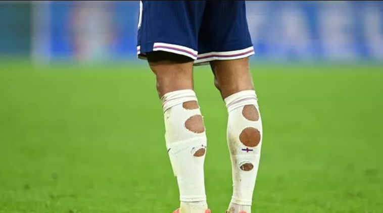 Why Do Footballers Like Jude Bellingham Cut Holes in Their Socks 1